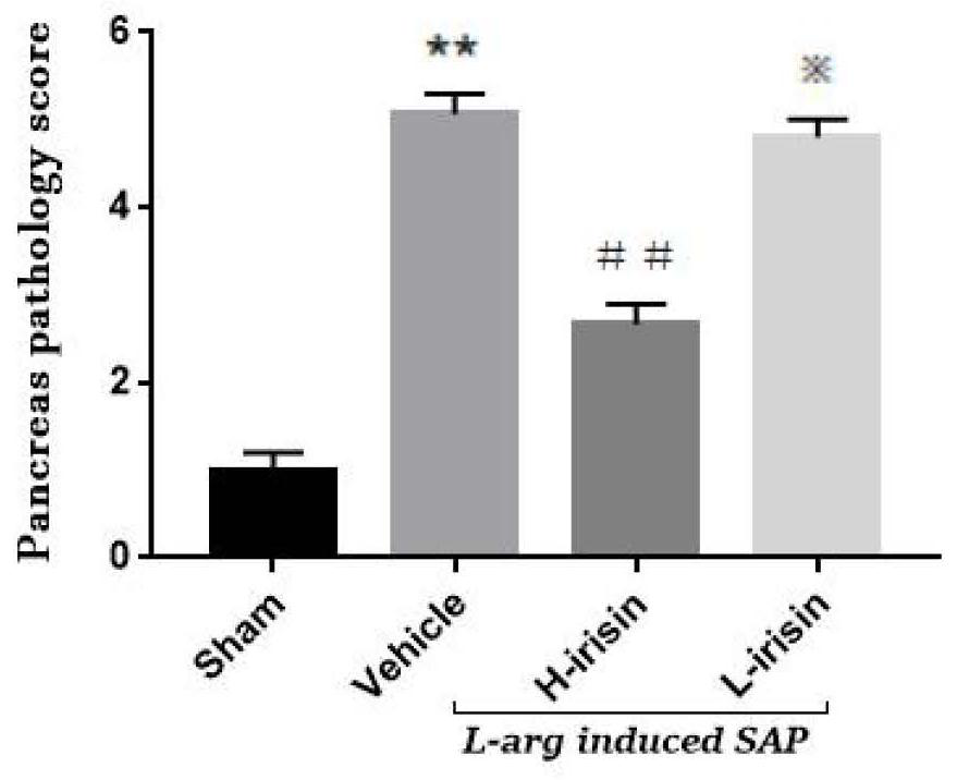 Application of irisin in the preparation of medicines for the prevention and treatment of severe acute pancreatitis