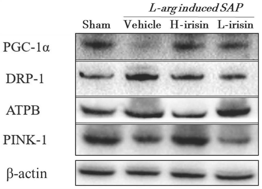 Application of irisin in the preparation of medicines for the prevention and treatment of severe acute pancreatitis