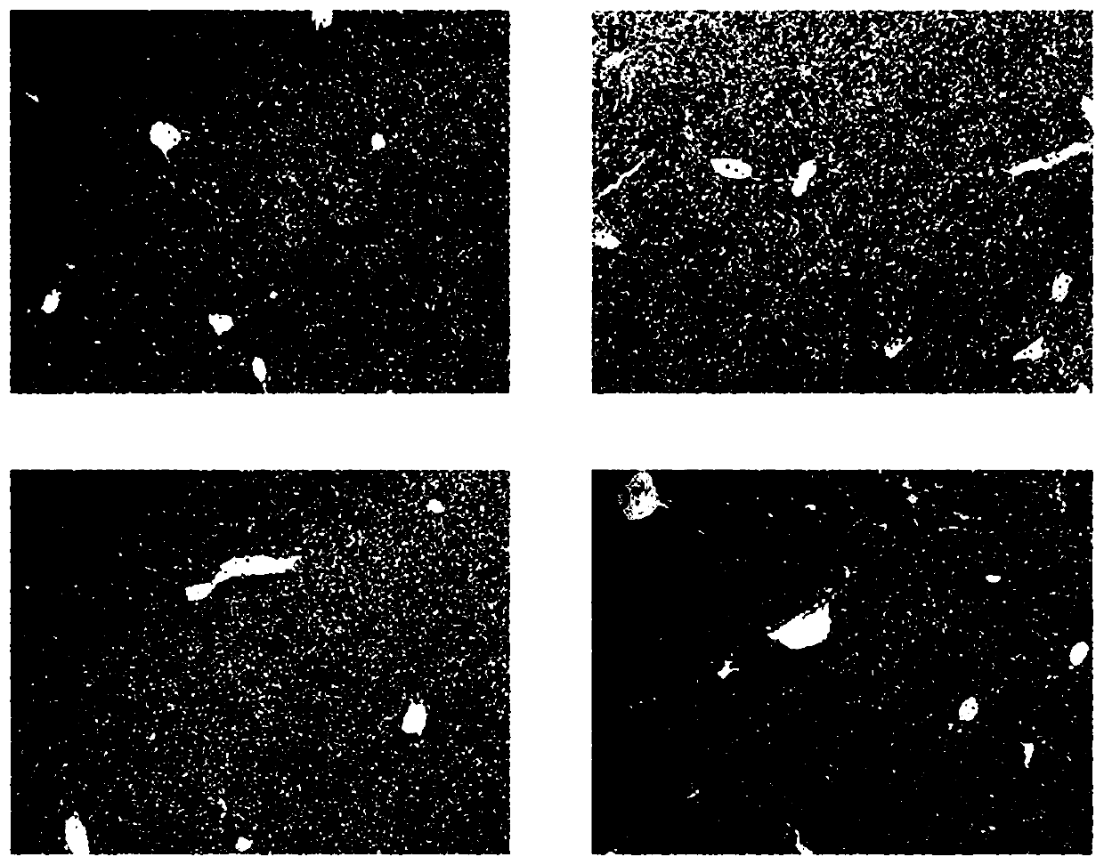 Preparation containing camellia oleifera extract and application of preparation