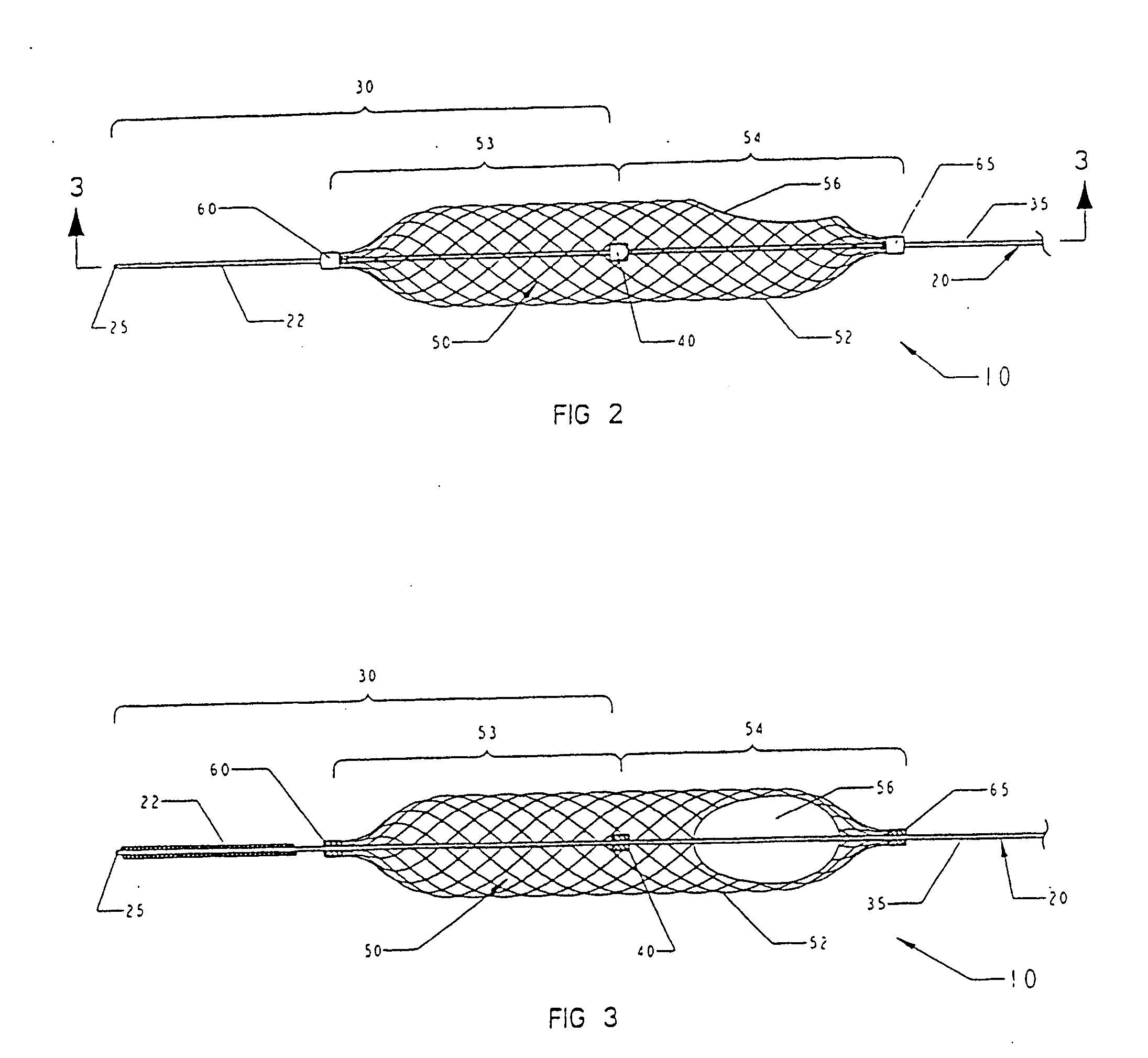 Temporary vascular filter