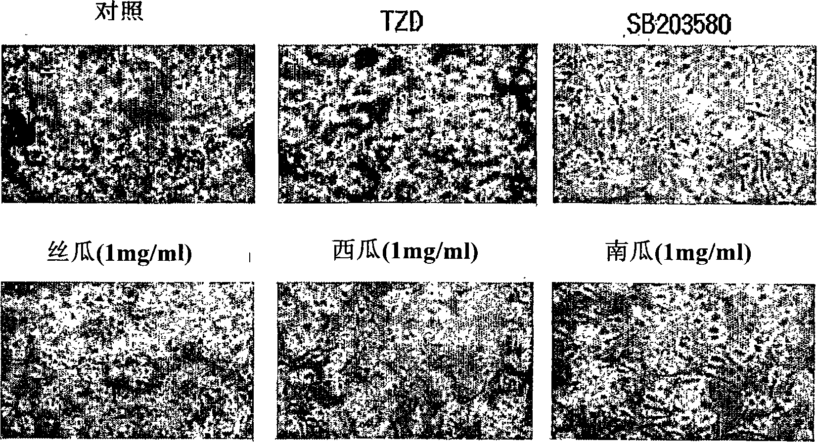 A composition comprising the extract of cucurbitaceae family plant or the purified extract isolated therefrom having anti-adipogenic and anti-obesity activity