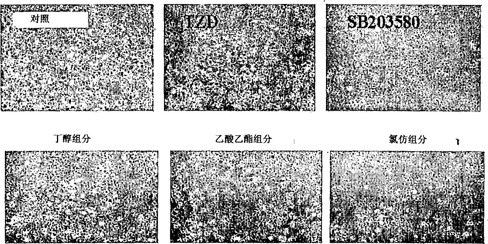 A composition comprising the extract of cucurbitaceae family plant or the purified extract isolated therefrom having anti-adipogenic and anti-obesity activity