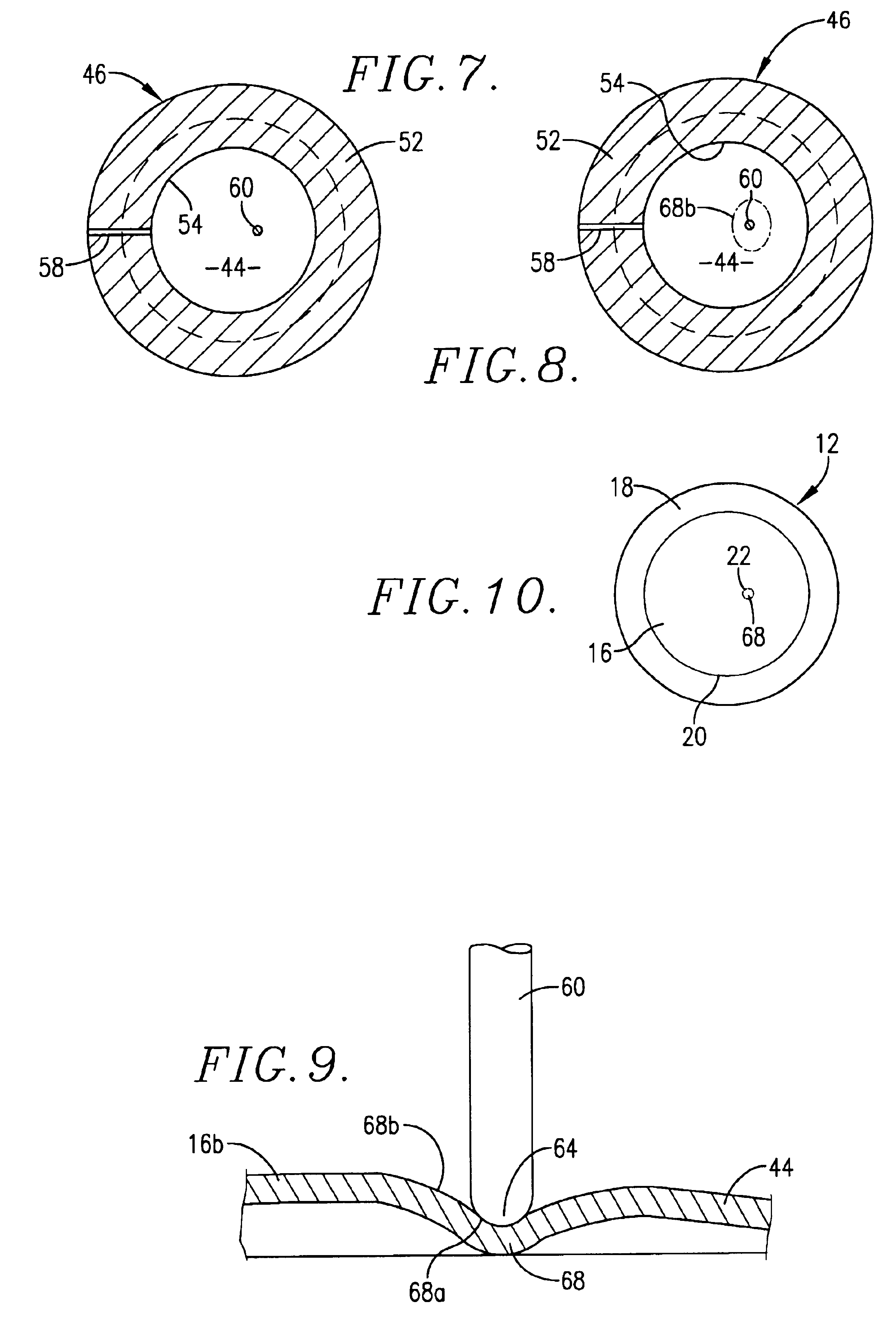 Reverse buckling sanitary rupture disc assembly