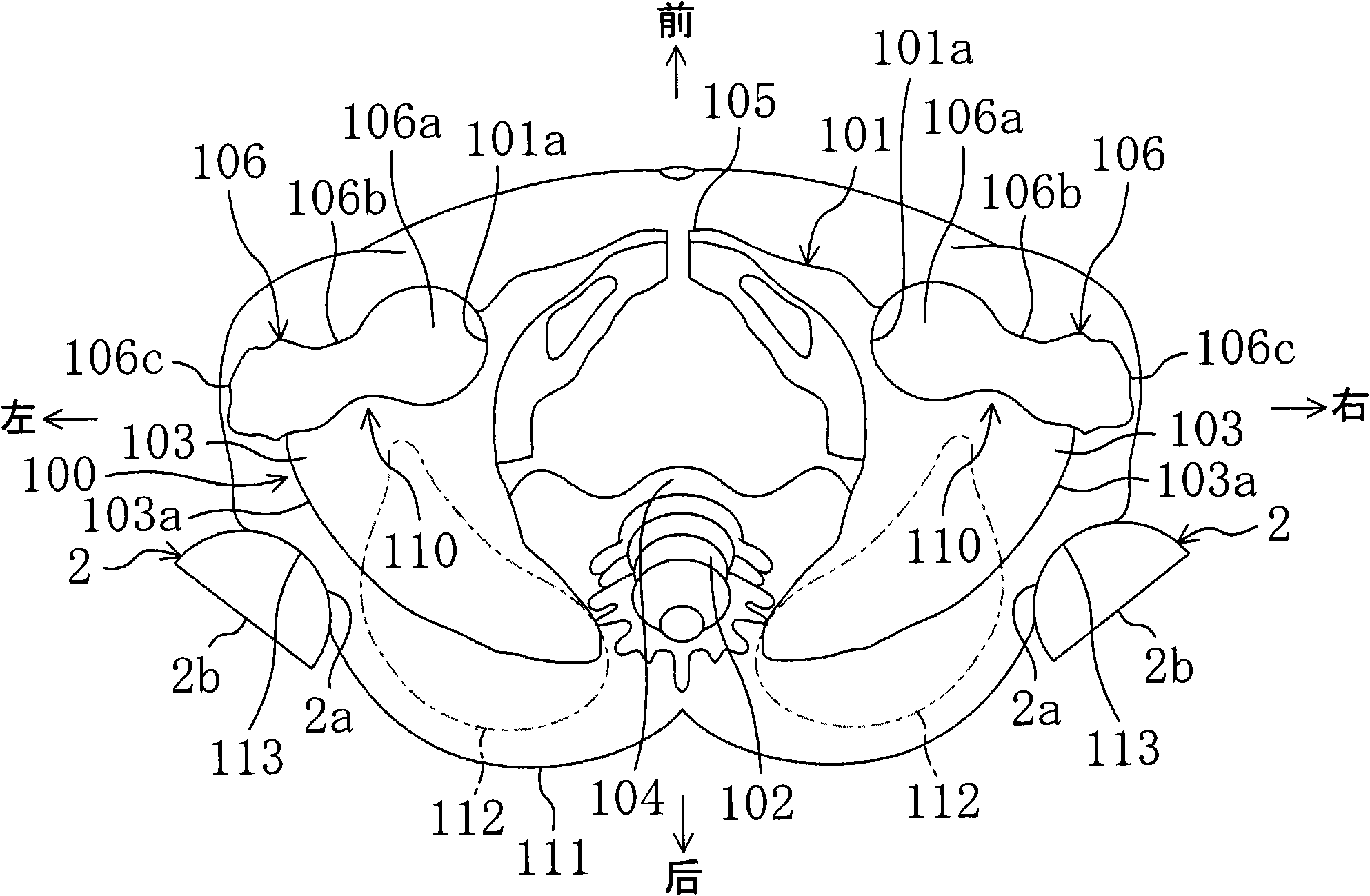 Pelvic band