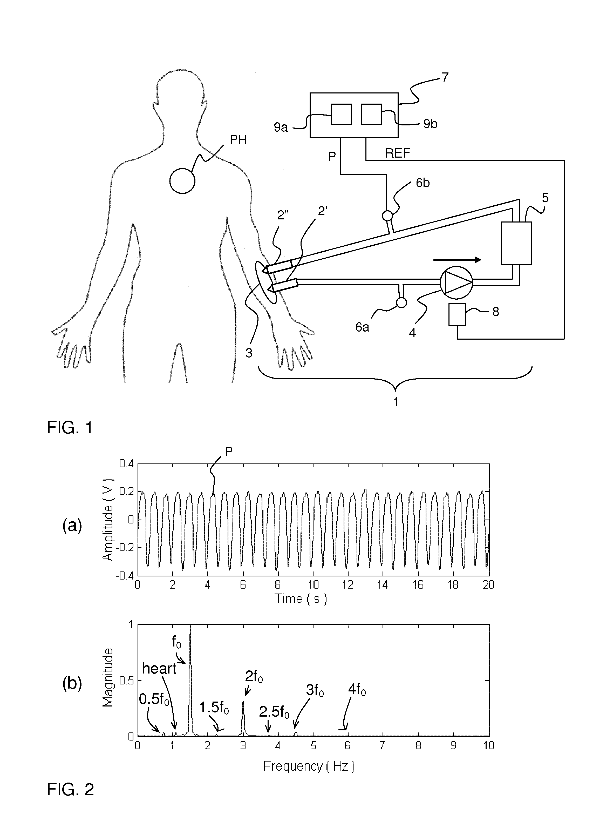 Separation of interference pulses from physiological pulses in a pressure signal