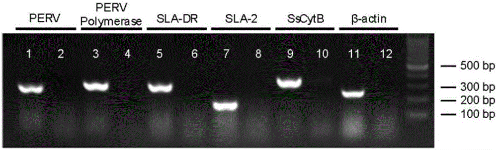 A decellularized liver bioscaffold with anticoagulant properties and preparation method thereof