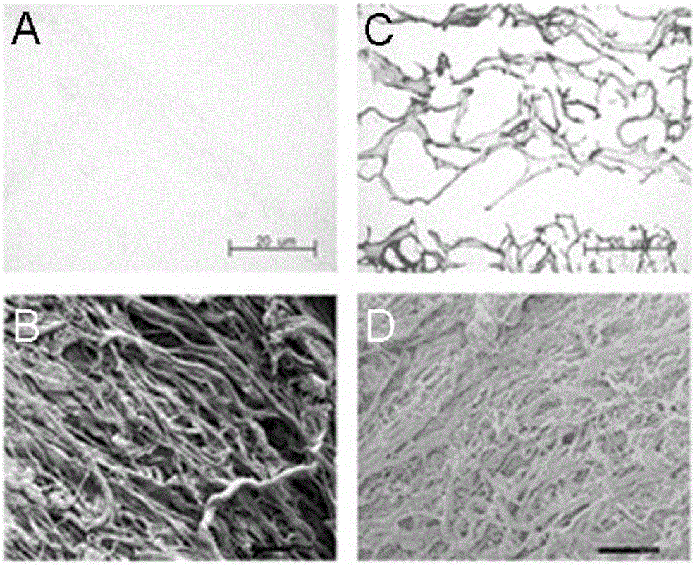 A decellularized liver bioscaffold with anticoagulant properties and preparation method thereof