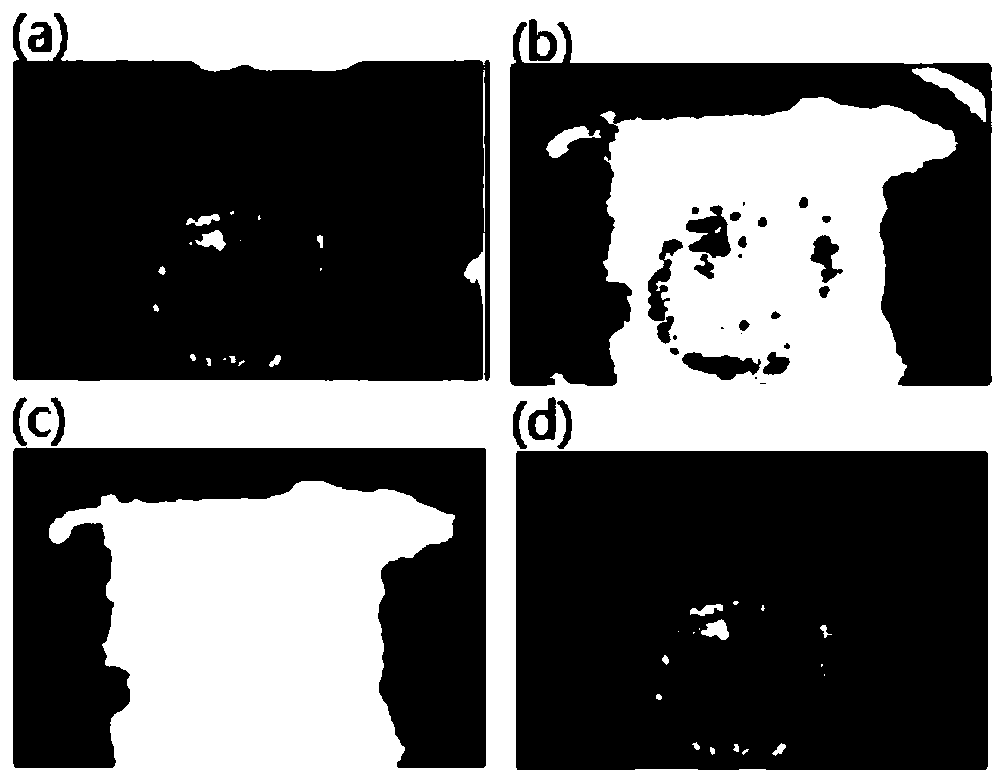 Sample data processing method for cervix uteri image