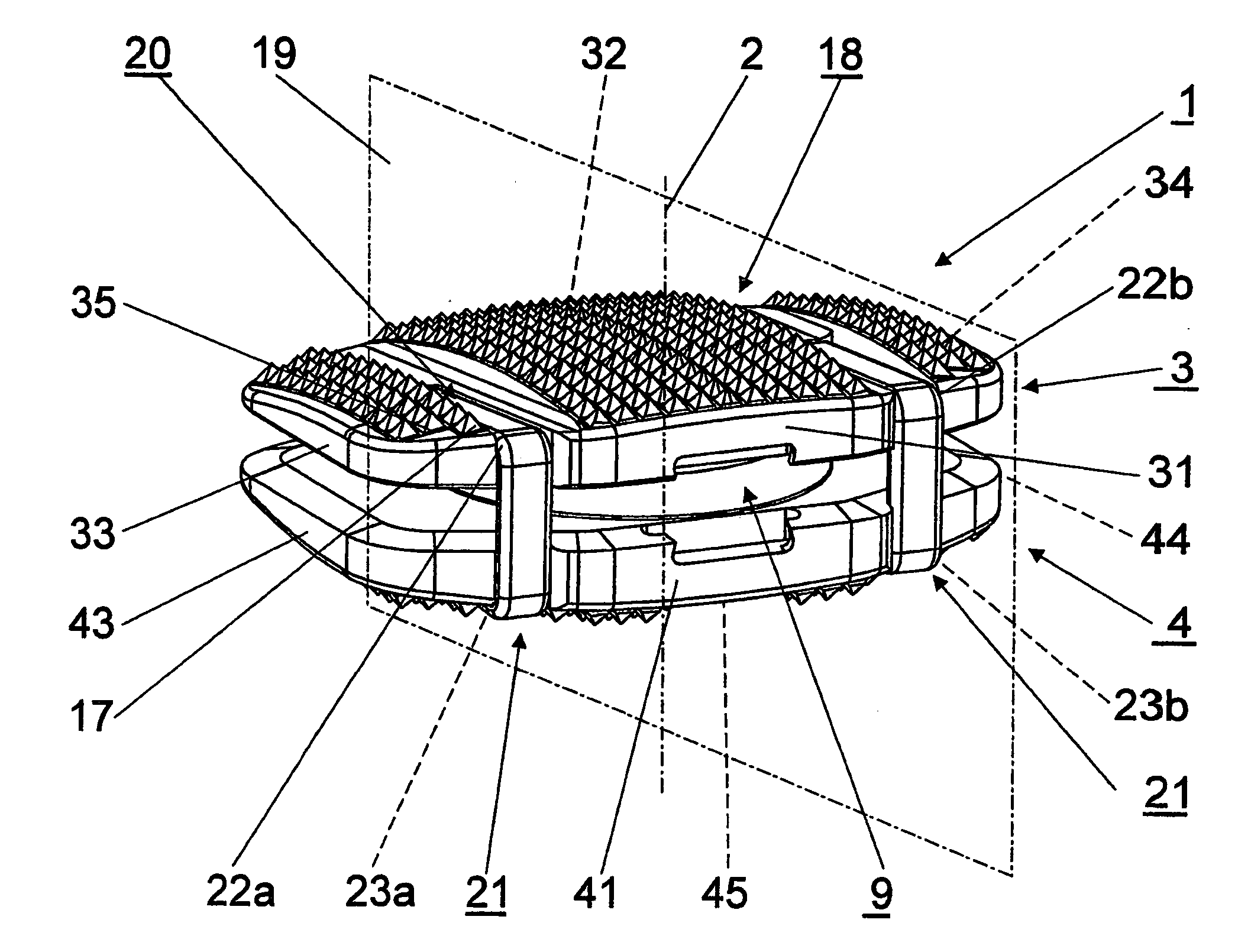 Intervertebral implant comprising temporary blocking means