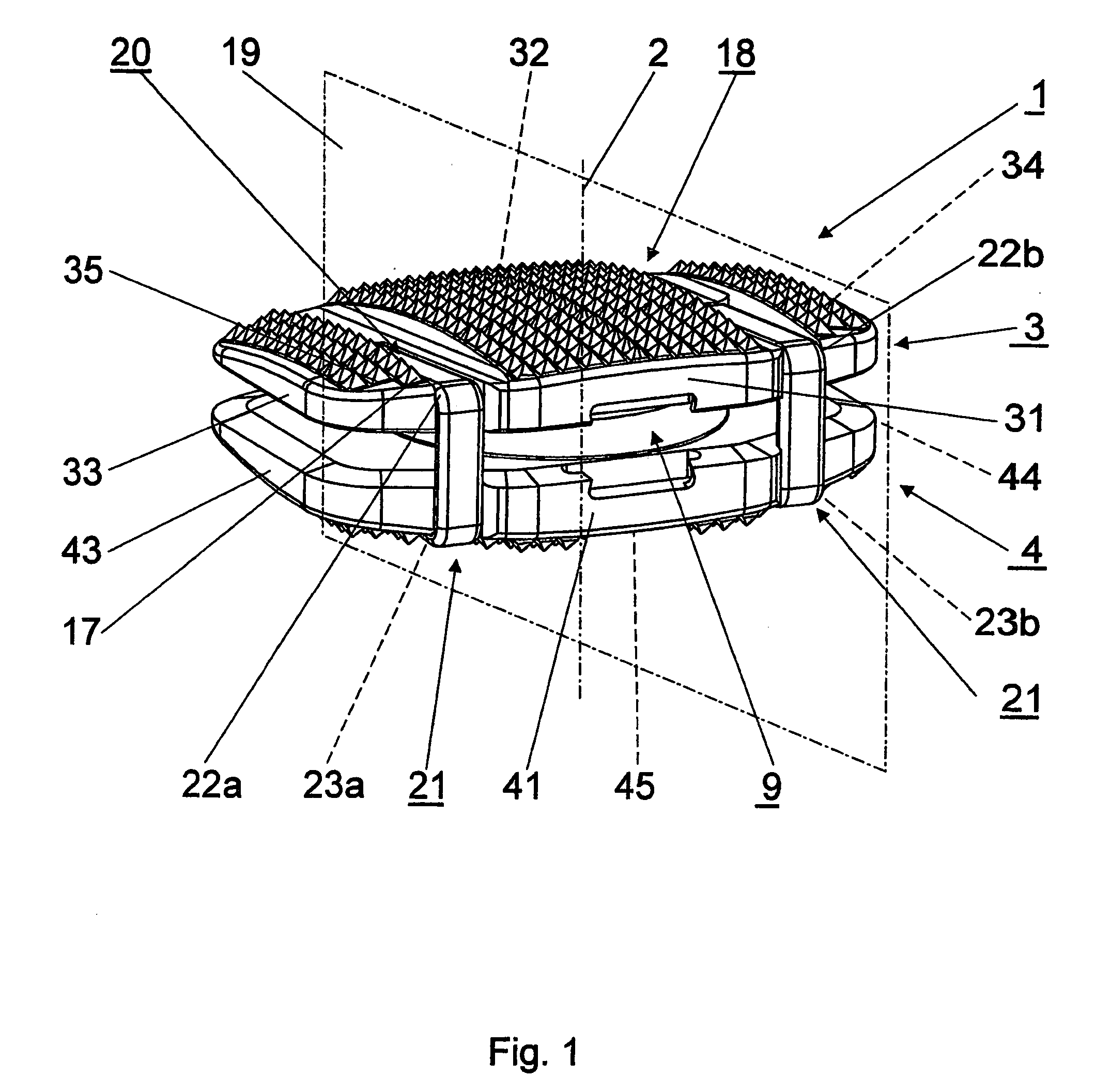 Intervertebral implant comprising temporary blocking means