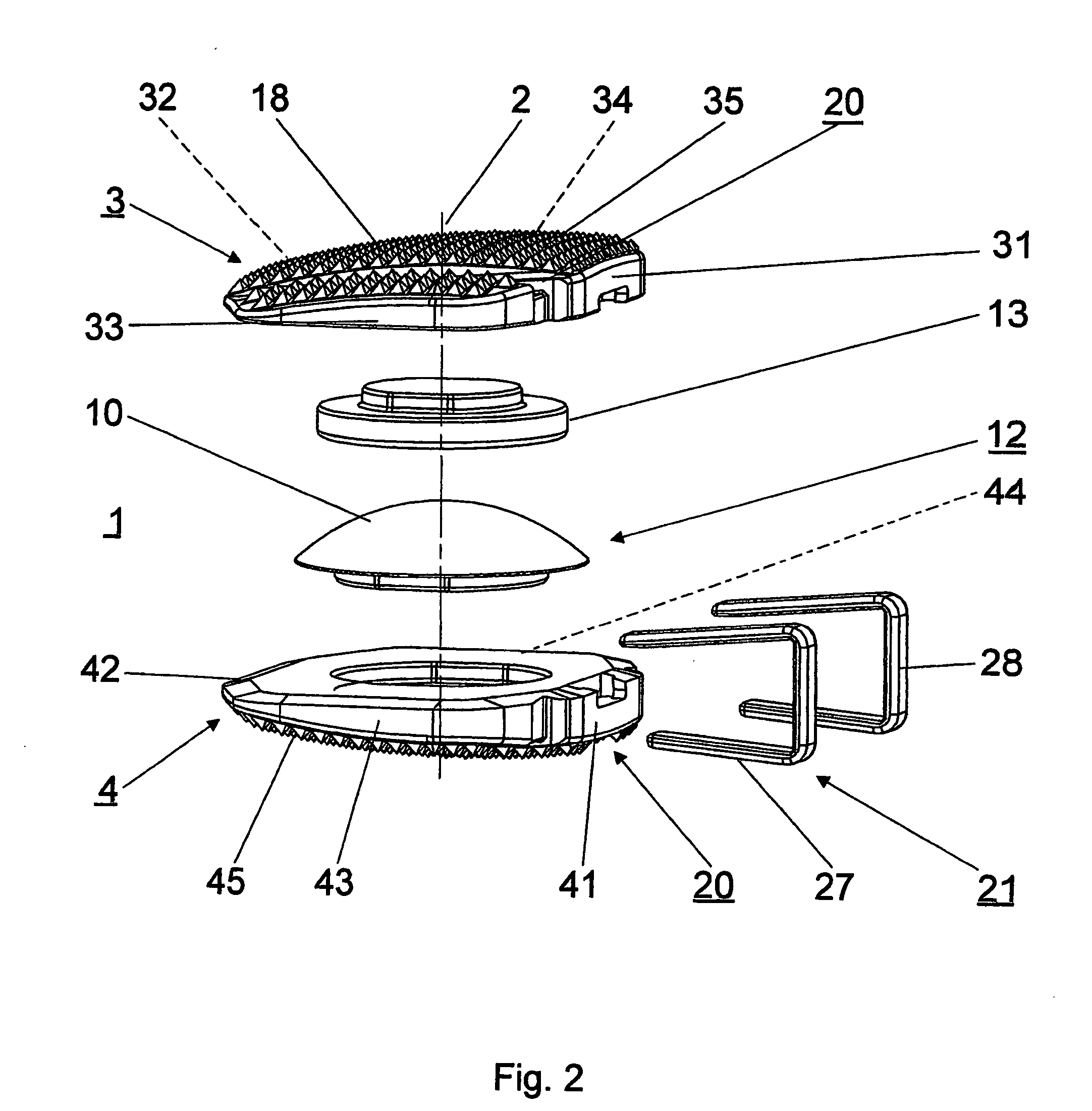 Intervertebral implant comprising temporary blocking means