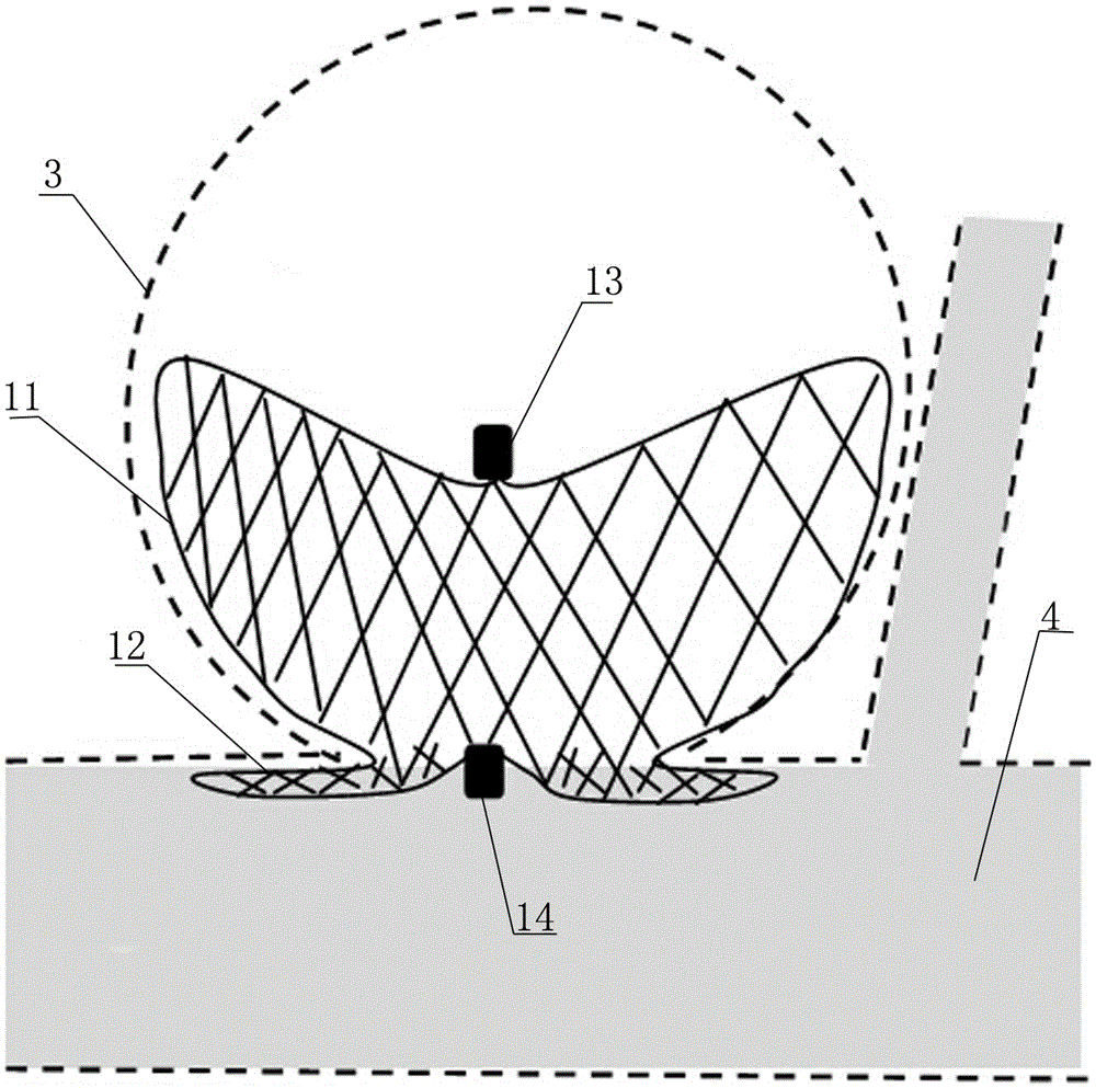 Intracranial aneurysm interventional embolization treatment device