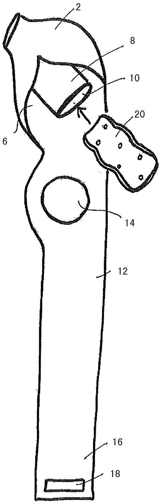 Thumb orthosis