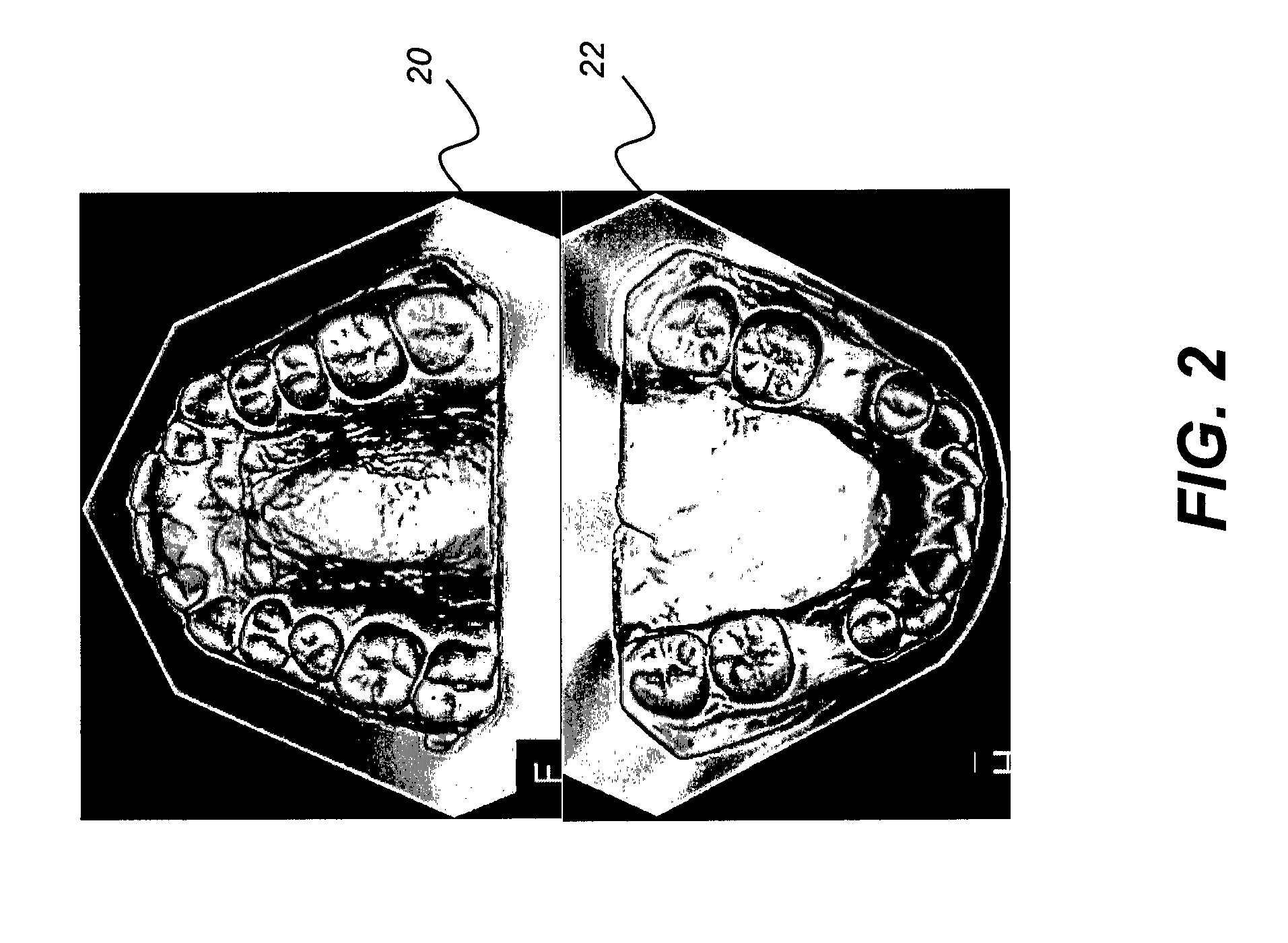 Occlusion mapping using elastic foam modeling