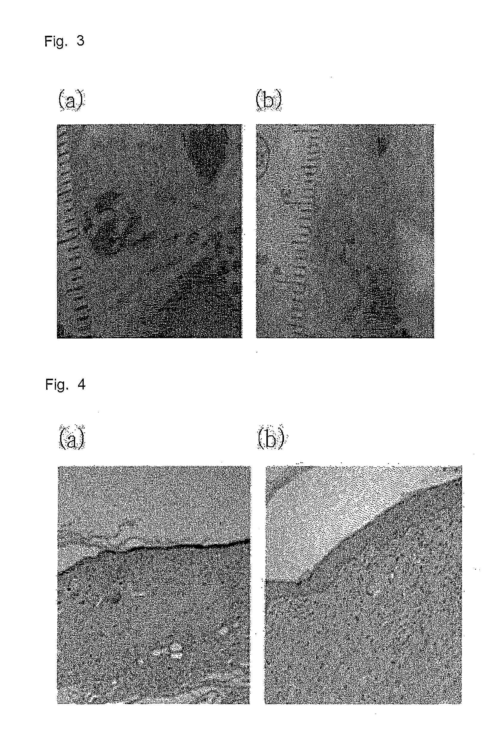 Hydrogel Type Cell Delivery Vehicle for Wound Healing, and Preparation Method Thereof