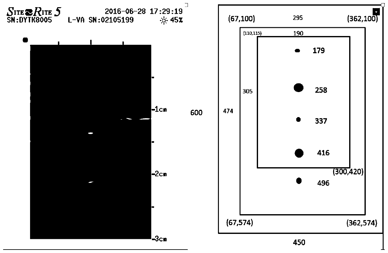 A method and device for automatic positioning of indwelling needle in punctured vein