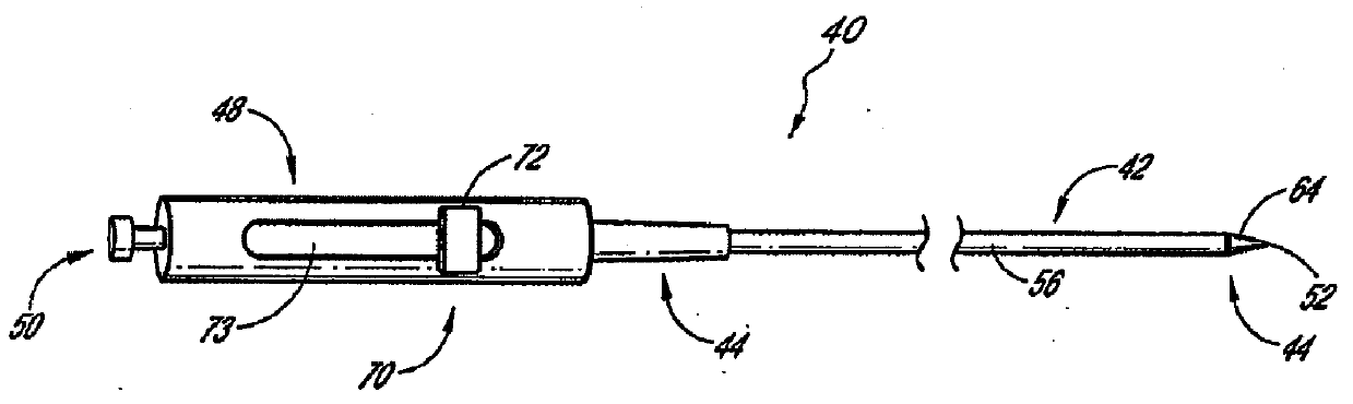 Methods and apparatus for treating neurovascular venous outflow obstruction