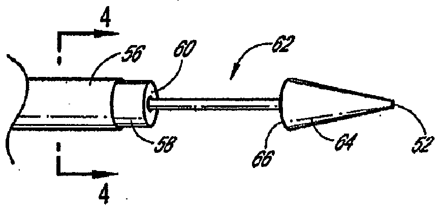 Methods and apparatus for treating neurovascular venous outflow obstruction