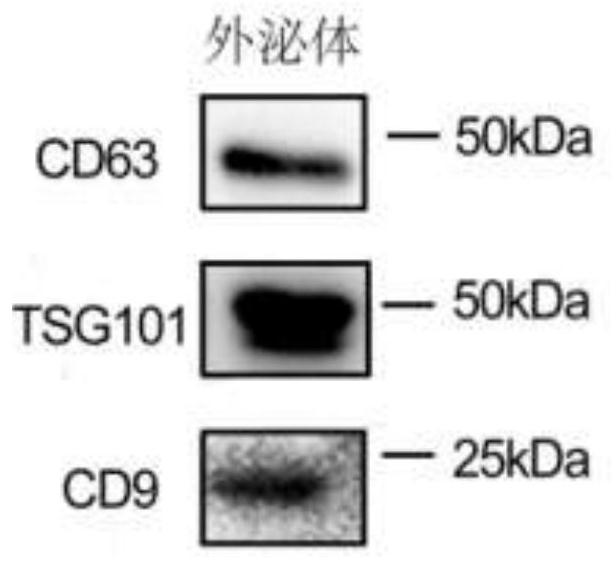 Application of brown adipocyte-derived exosome