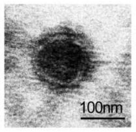 Application of brown adipocyte-derived exosome