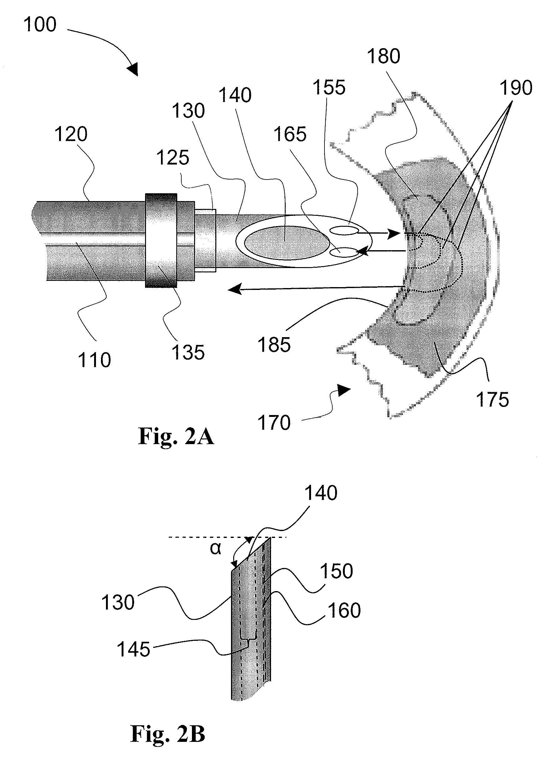 Method and apparatus for identifying and treating myocardial infarction