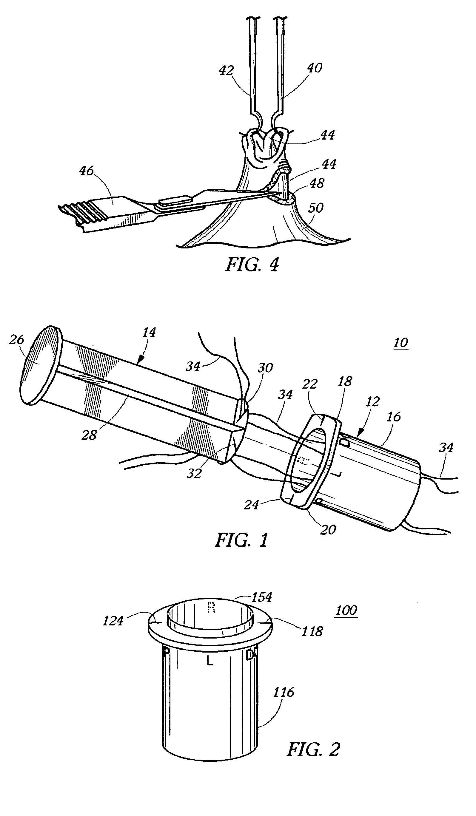 Method and device for umbilicus protection during abdominal surgery