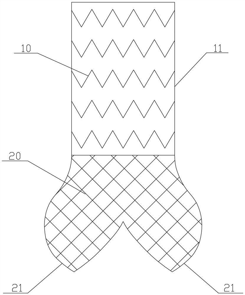 Aortic root stent system