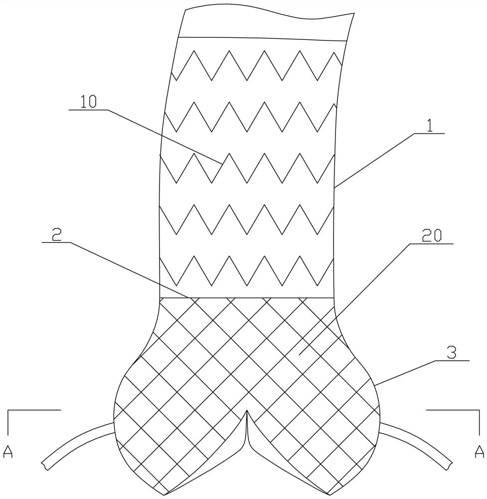 Aortic root stent system