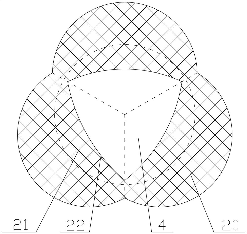 Aortic root stent system