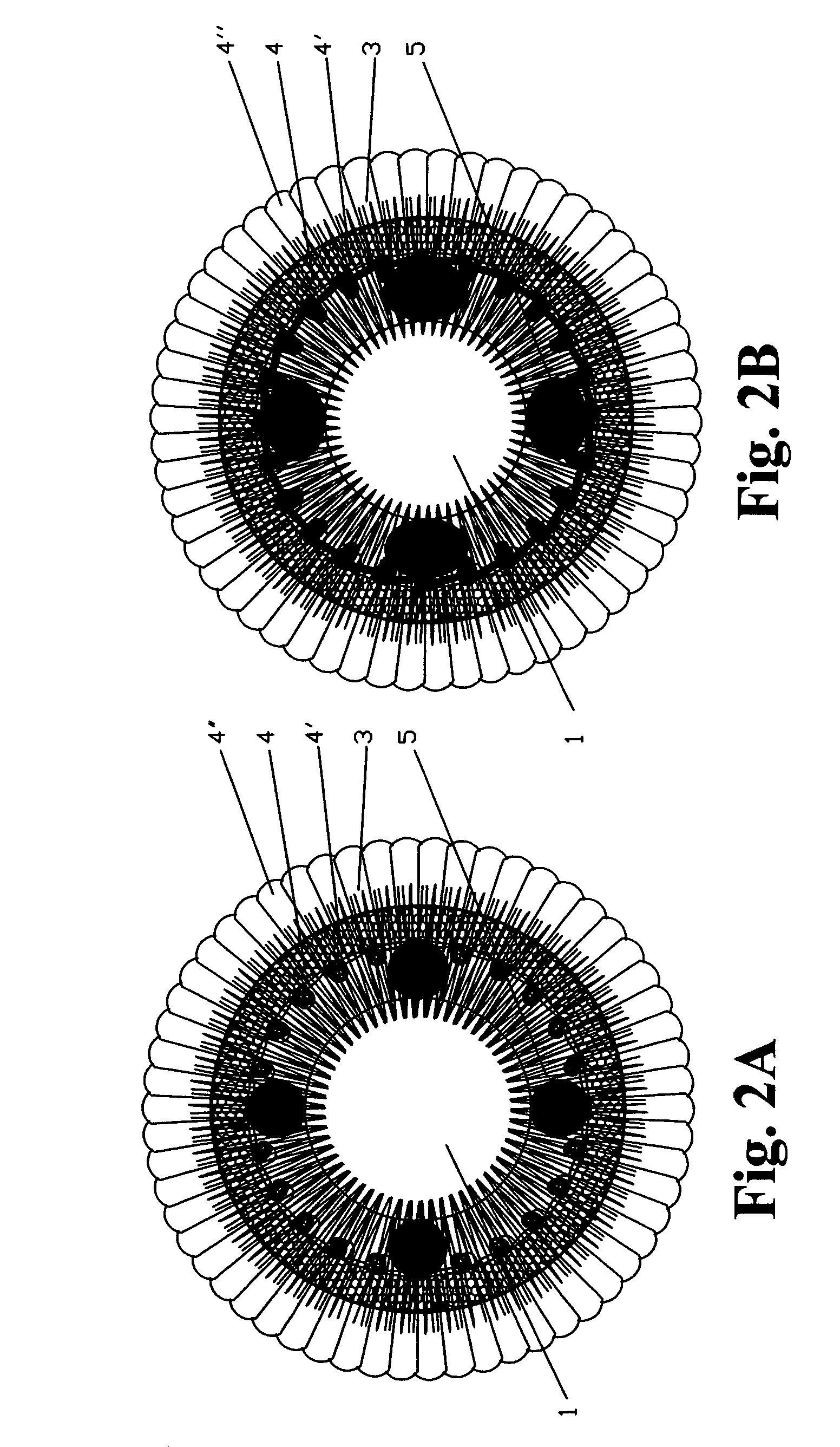 Accommodating zonular mini-bridge implants