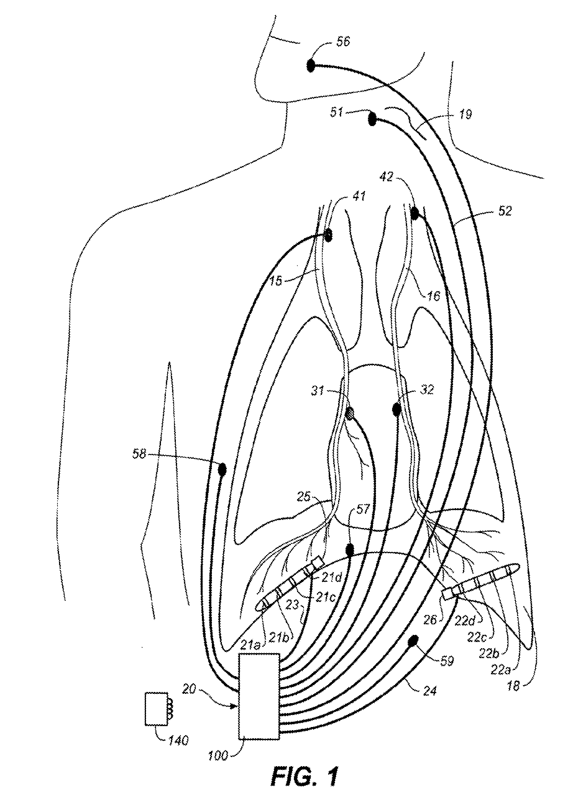 Therapeutic diaphragm stimulation device and method