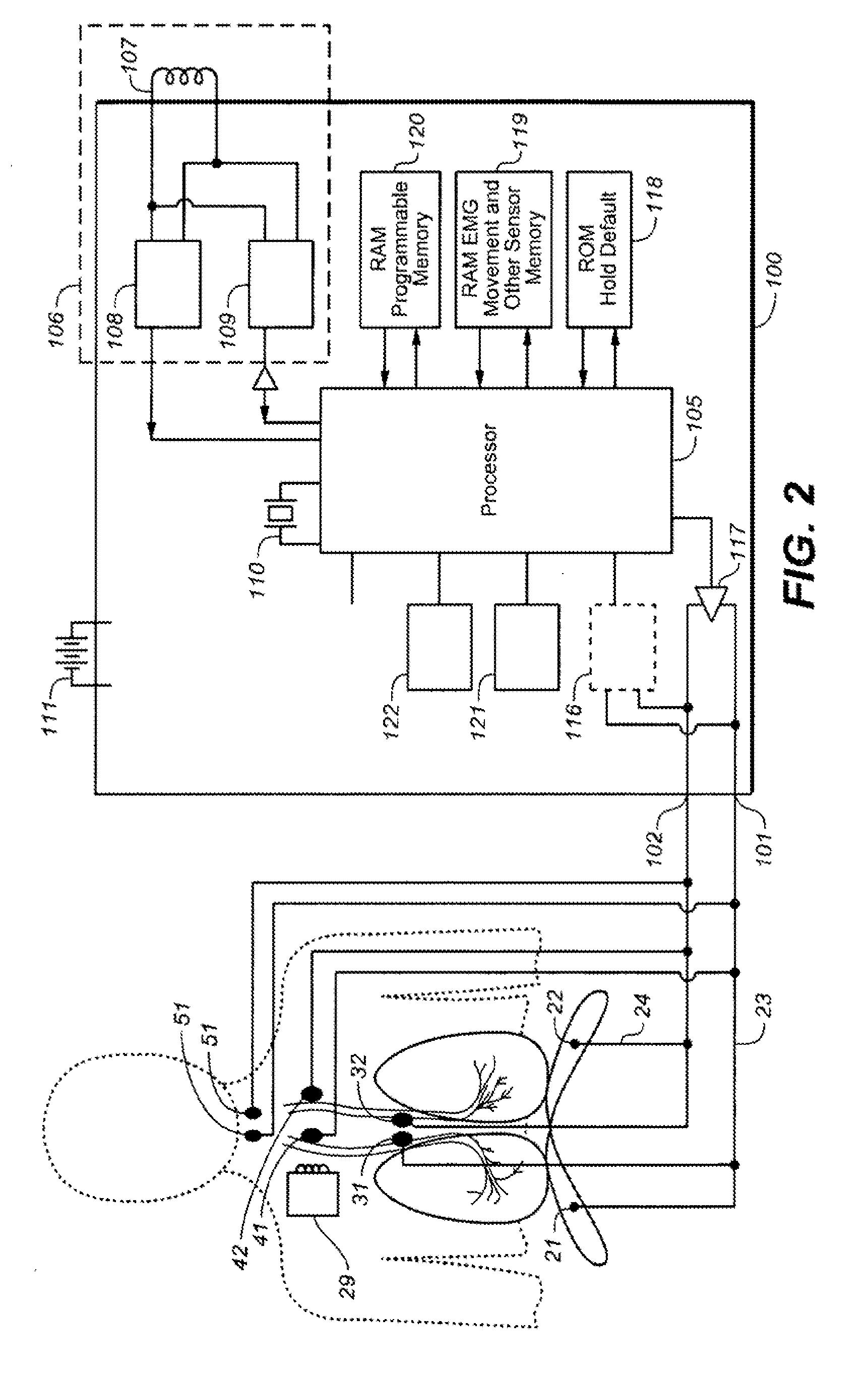 Therapeutic diaphragm stimulation device and method