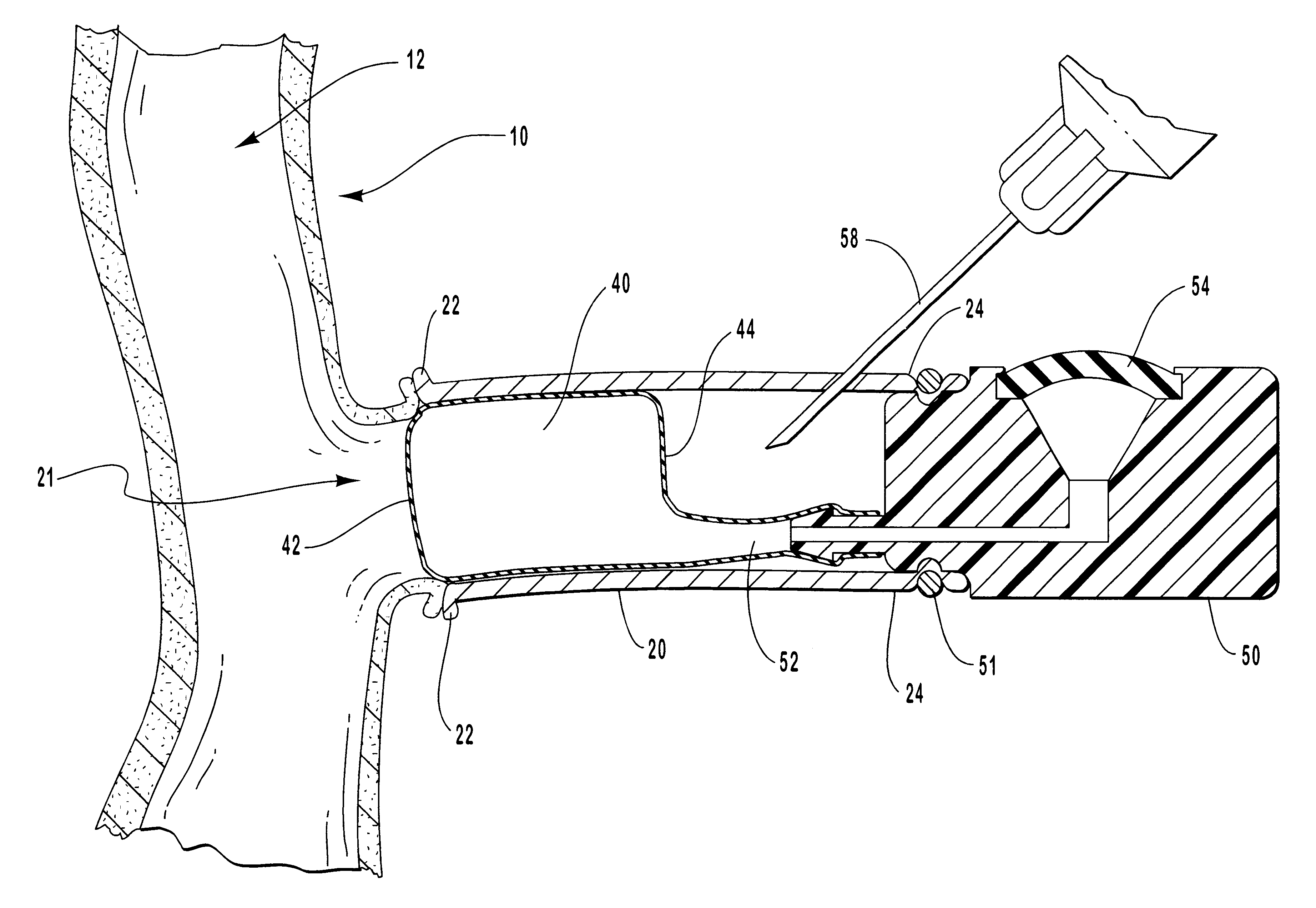 Vascular access devices and systems