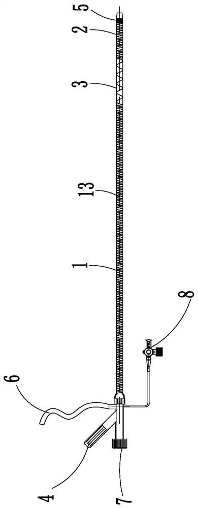 Thrombus treatment platform