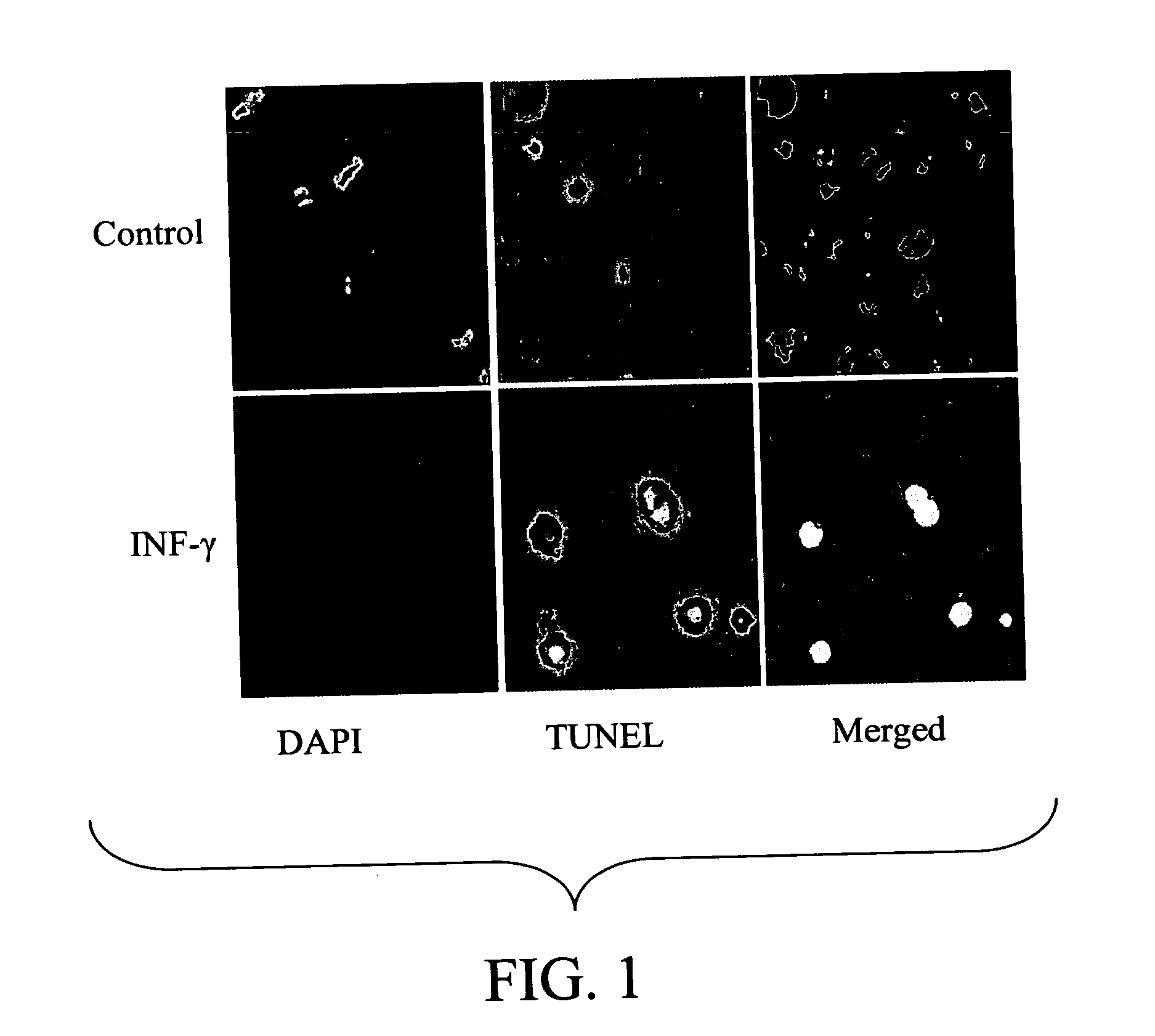 Nanogene therapy for cell proliferation disorders