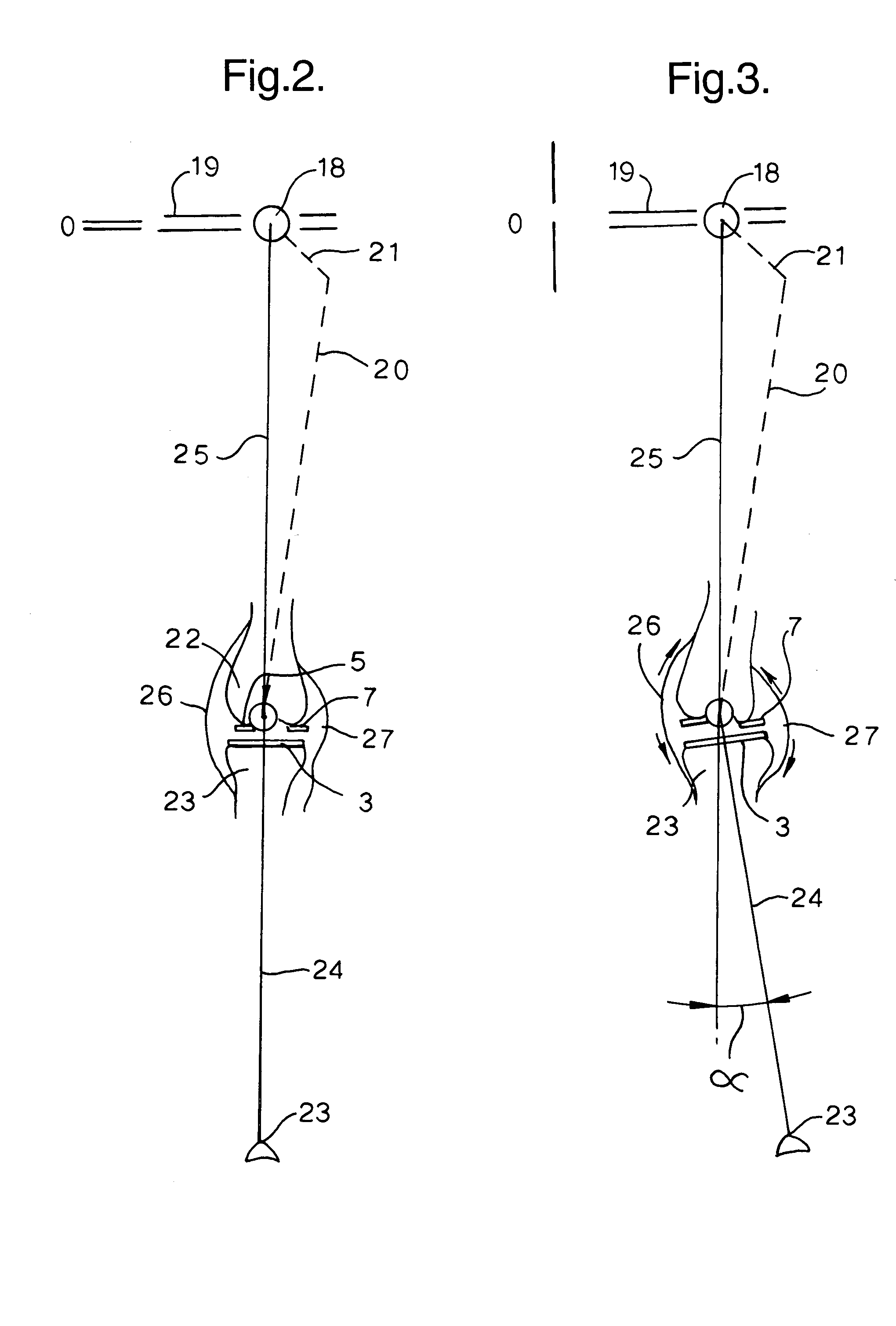 Apparatus, operating means and process