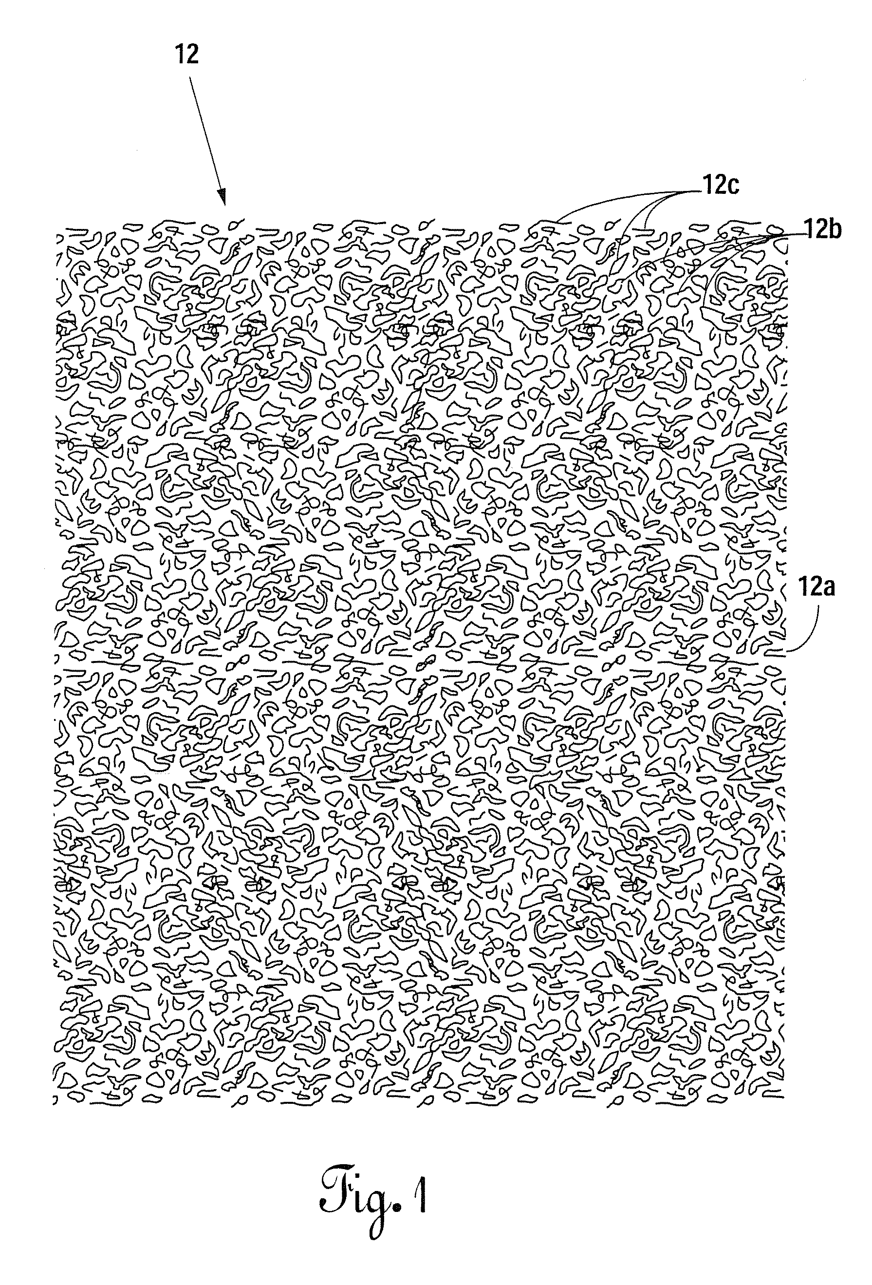 Elastomeric gasket having a foam metal skeletal member