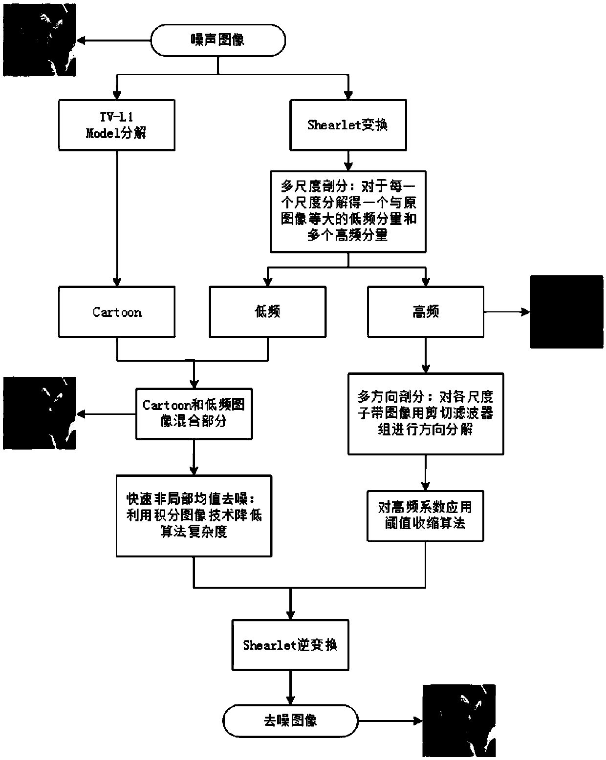 A shear wave transformation medical CT image denoising method based on a fast non-local mean value and a TV-L1 model