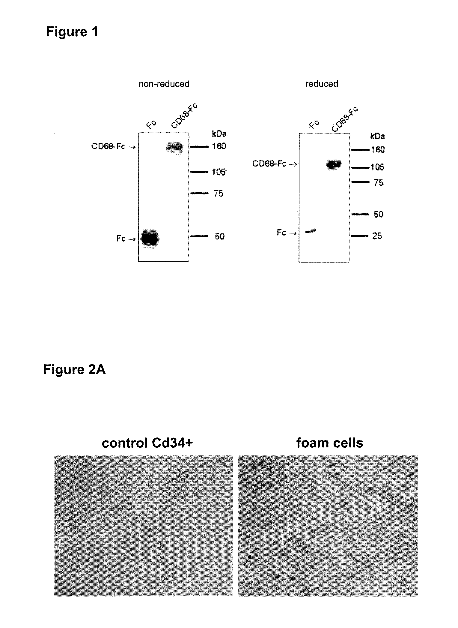 Anti-inflammatory fusion protein