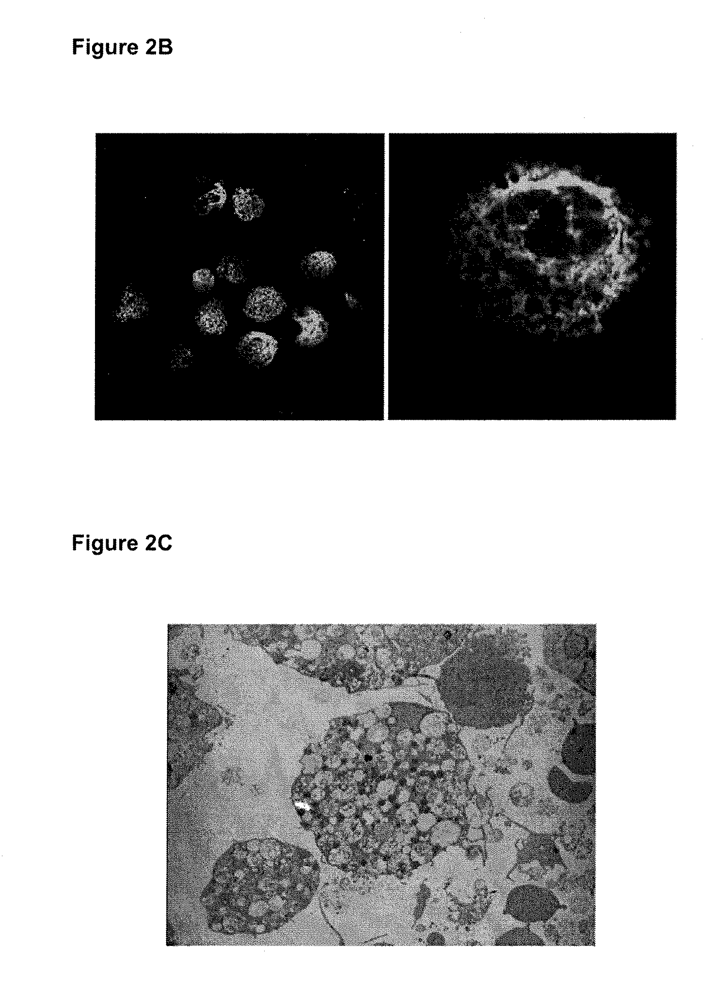 Anti-inflammatory fusion protein