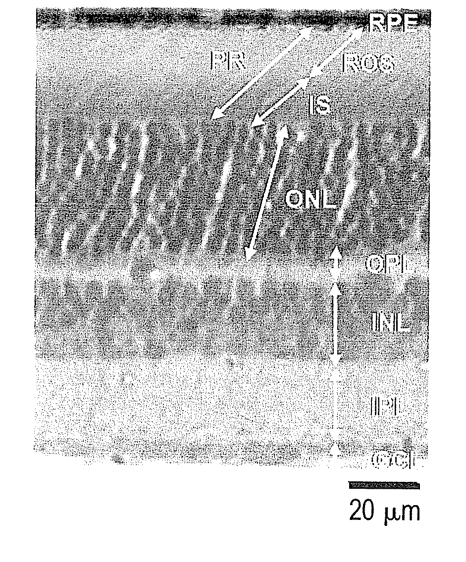 Methods for the treatment and prevention of age-related retinal dysfunction