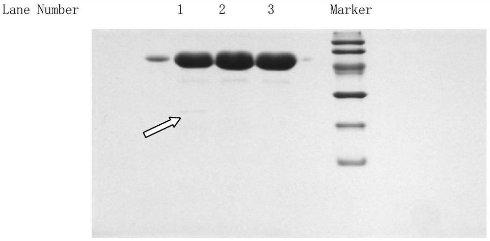 A kind of purification method of recombinant human urokinase