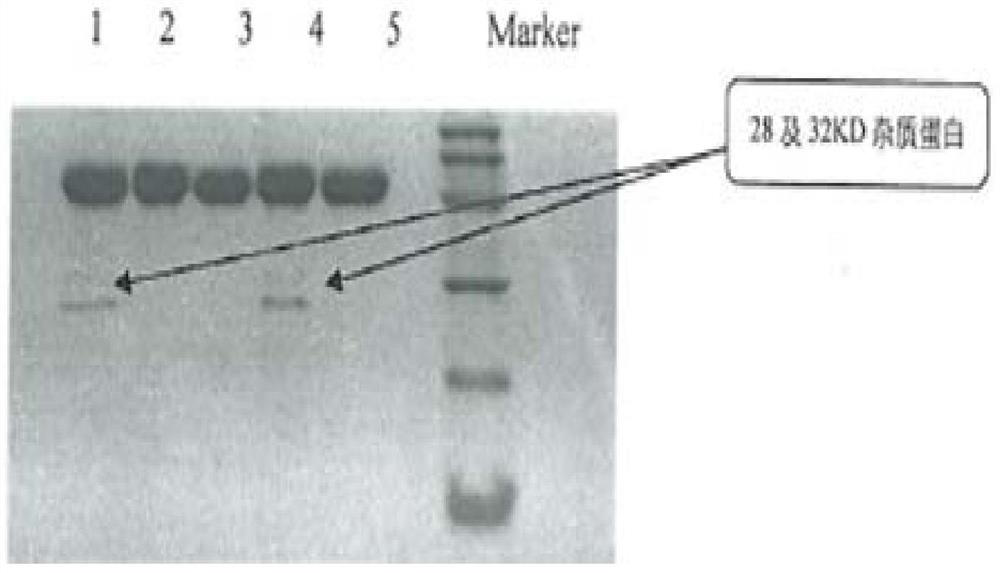 A kind of purification method of recombinant human urokinase