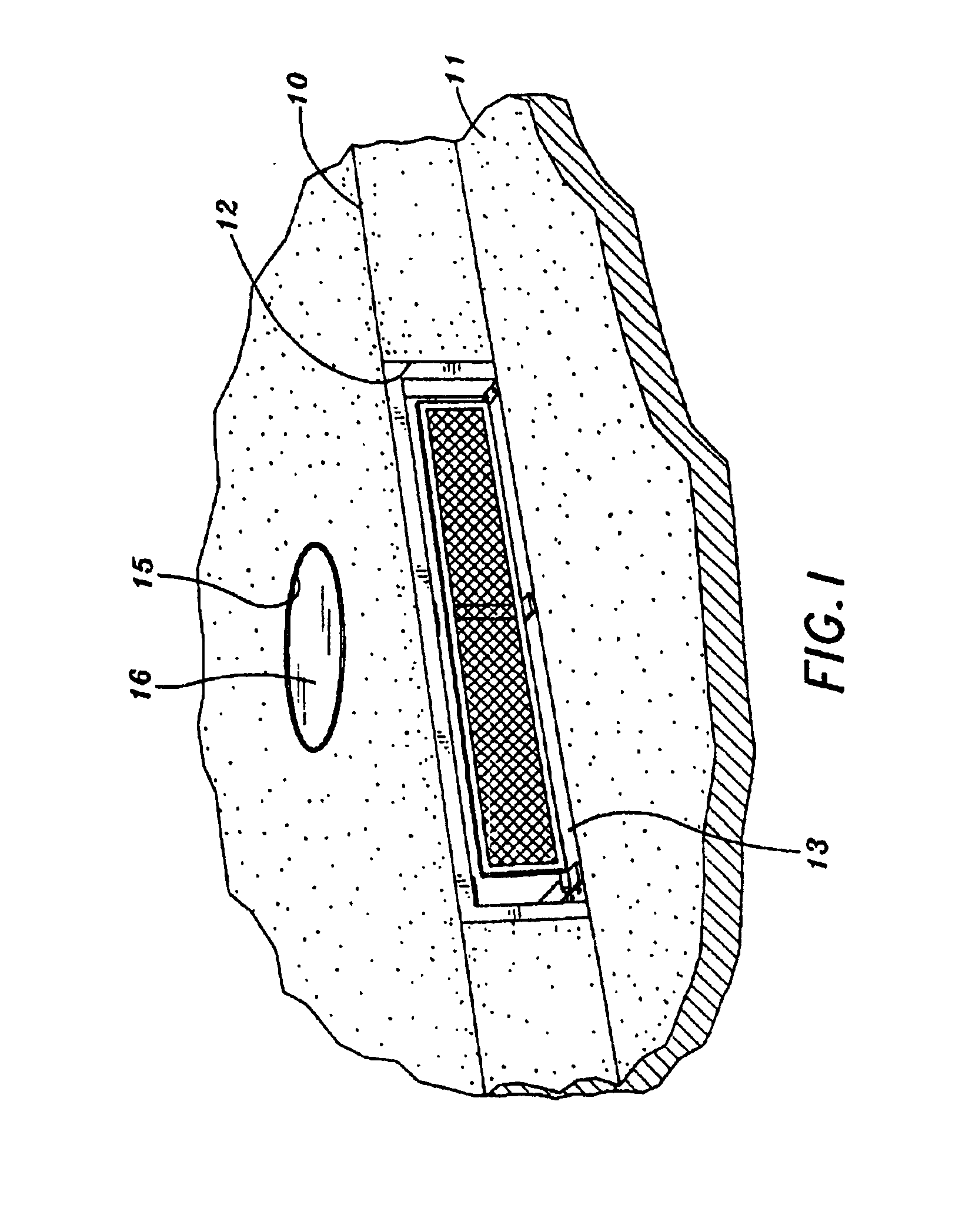 Curbside drain barrier for detaining solid trash during no or slow water flow