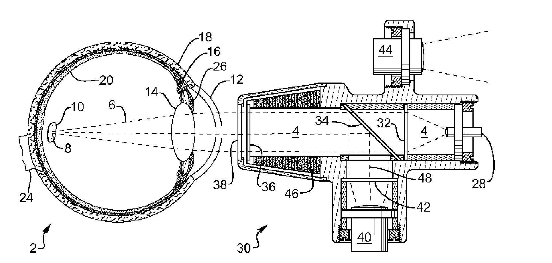 Pyrode neurostimulator