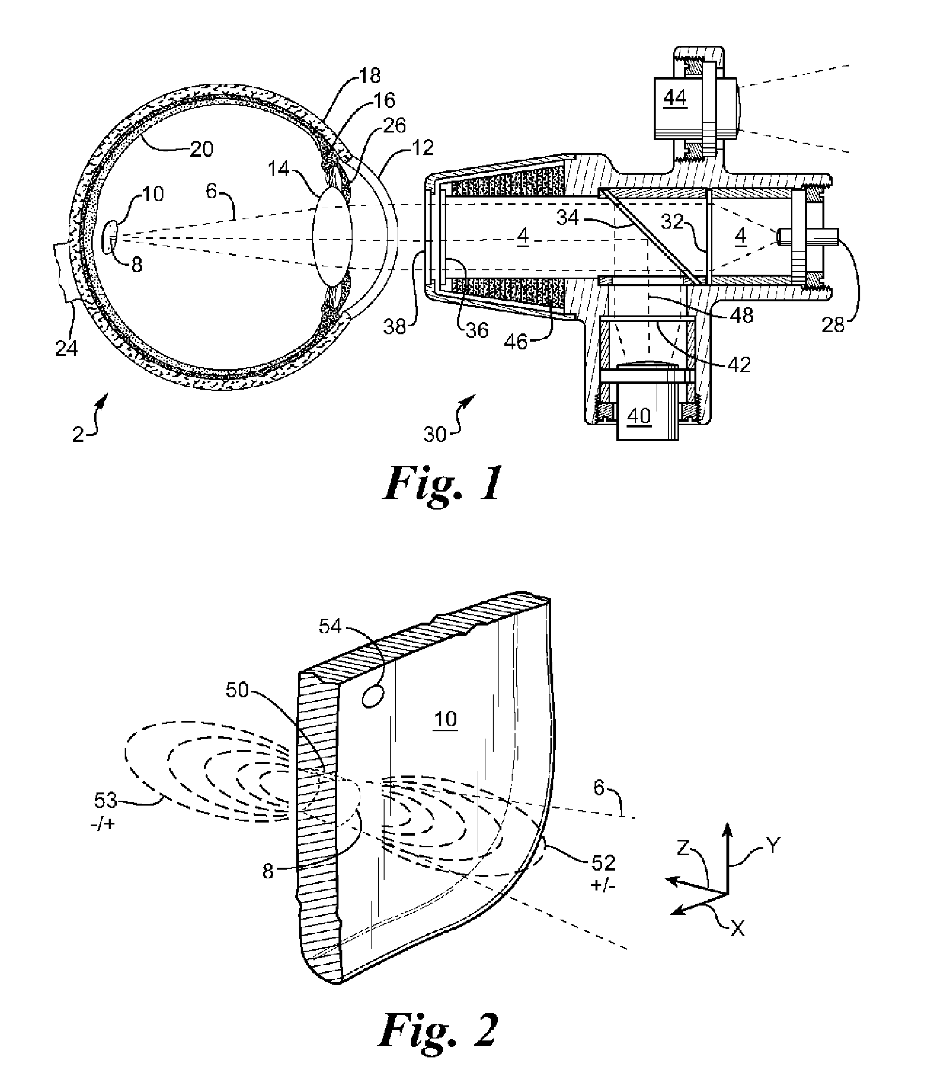 Pyrode neurostimulator