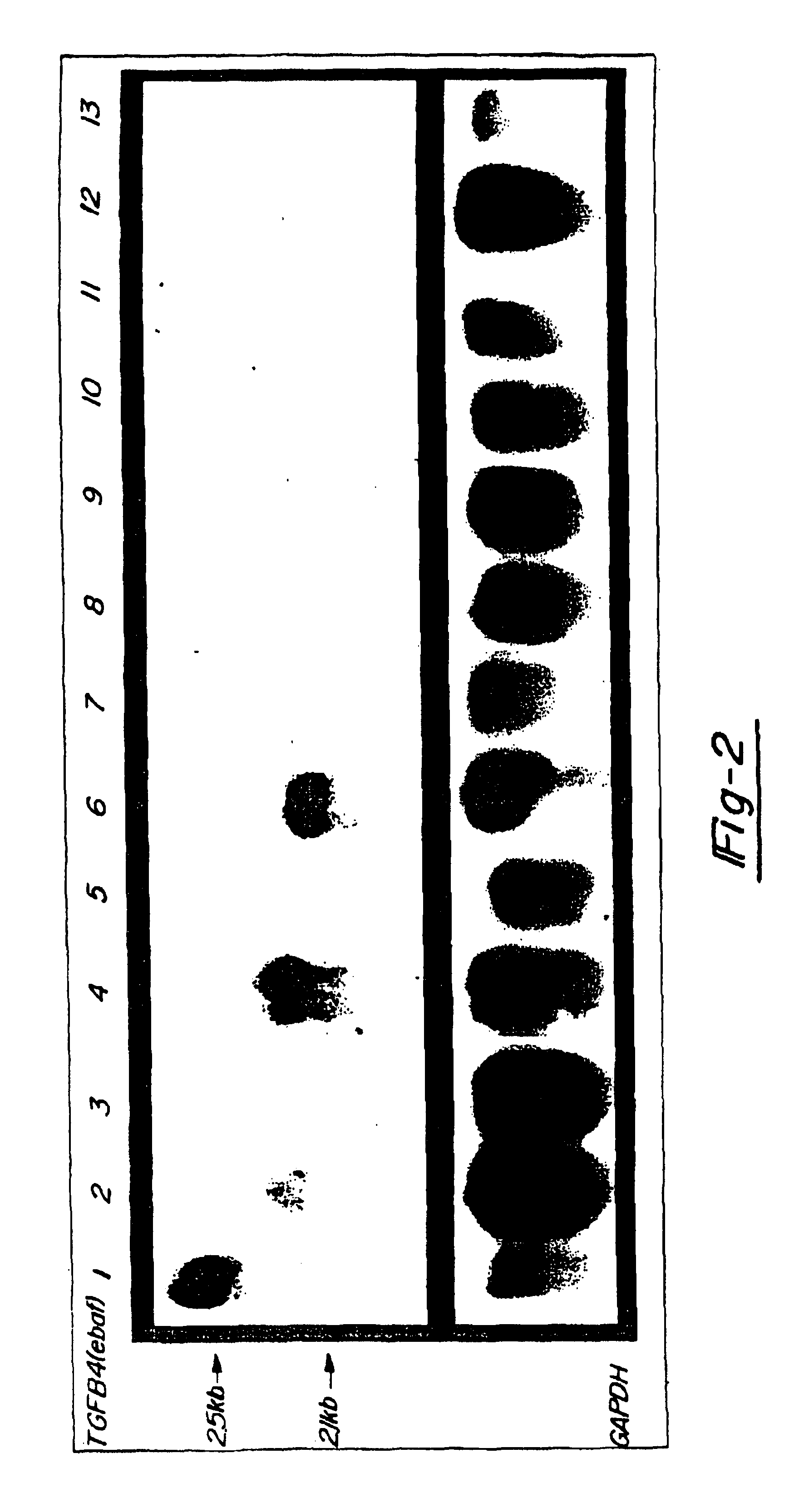 Nucleic acids encoding an endometrial bleeding associated factor (EBAF)