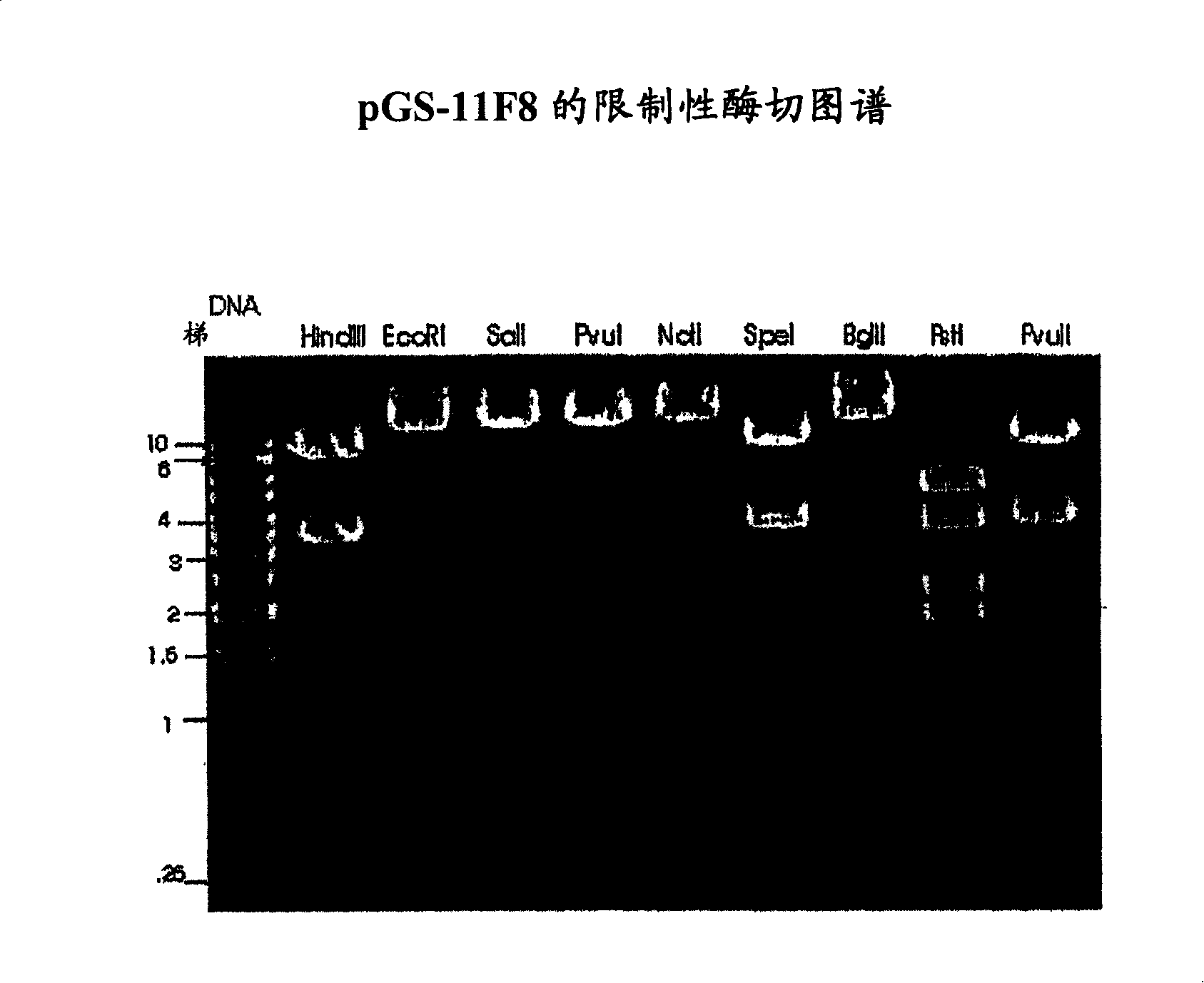 Human anti-epidermal growth factor receptor antibody