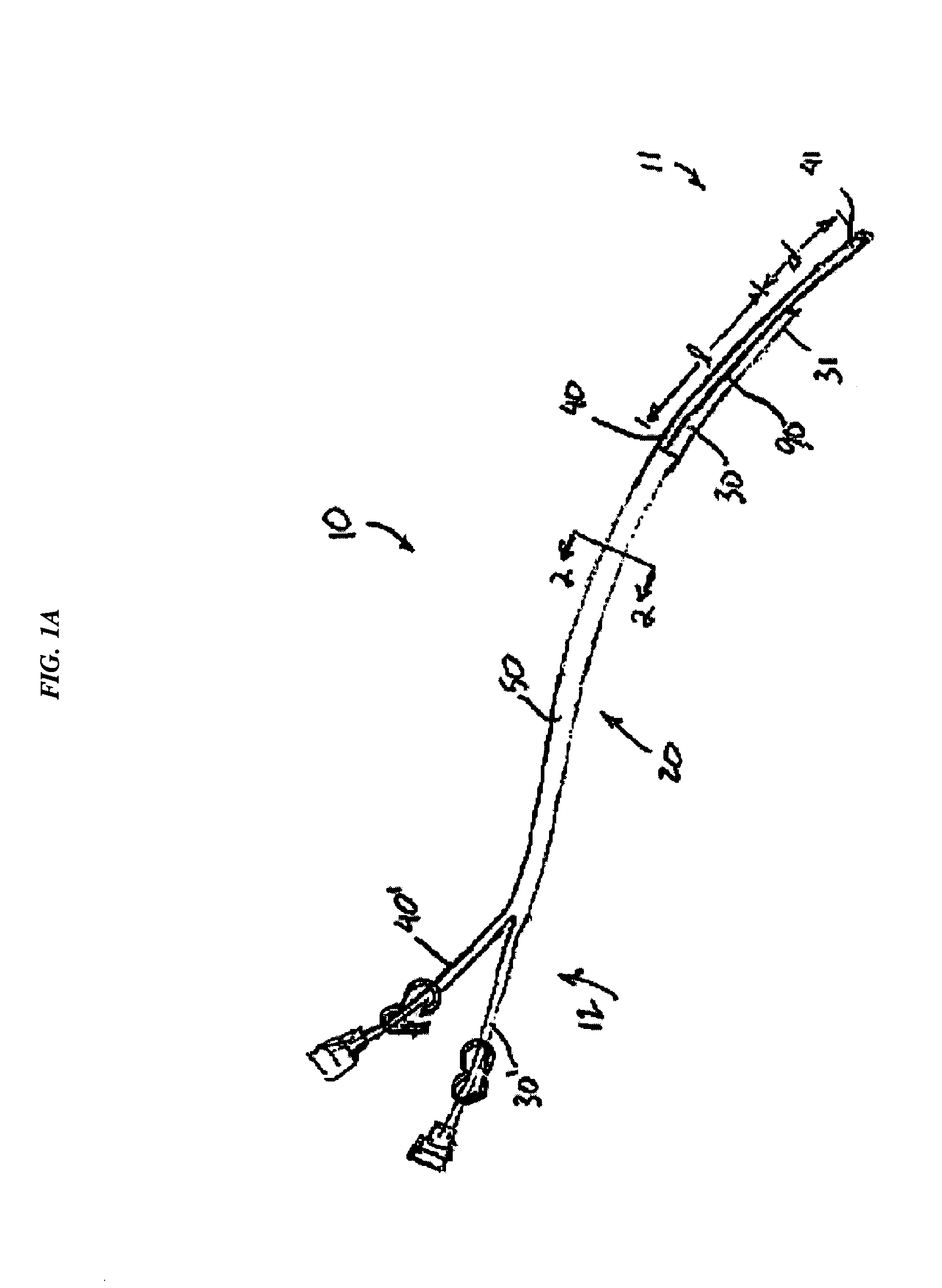 Splitable tip catheter with bioresorbable adhesive