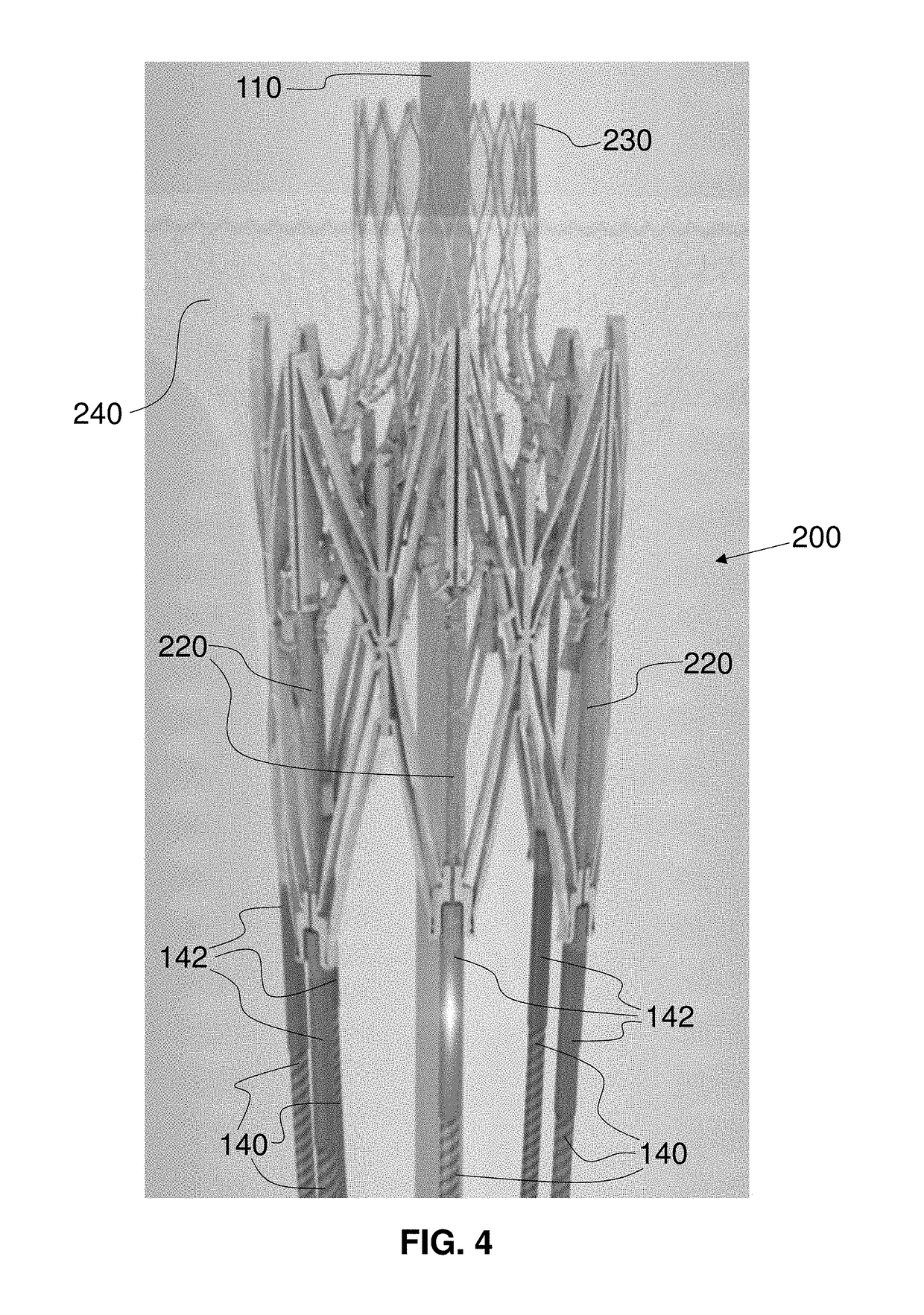 Actively controllable heart valve implant and method of controlling same